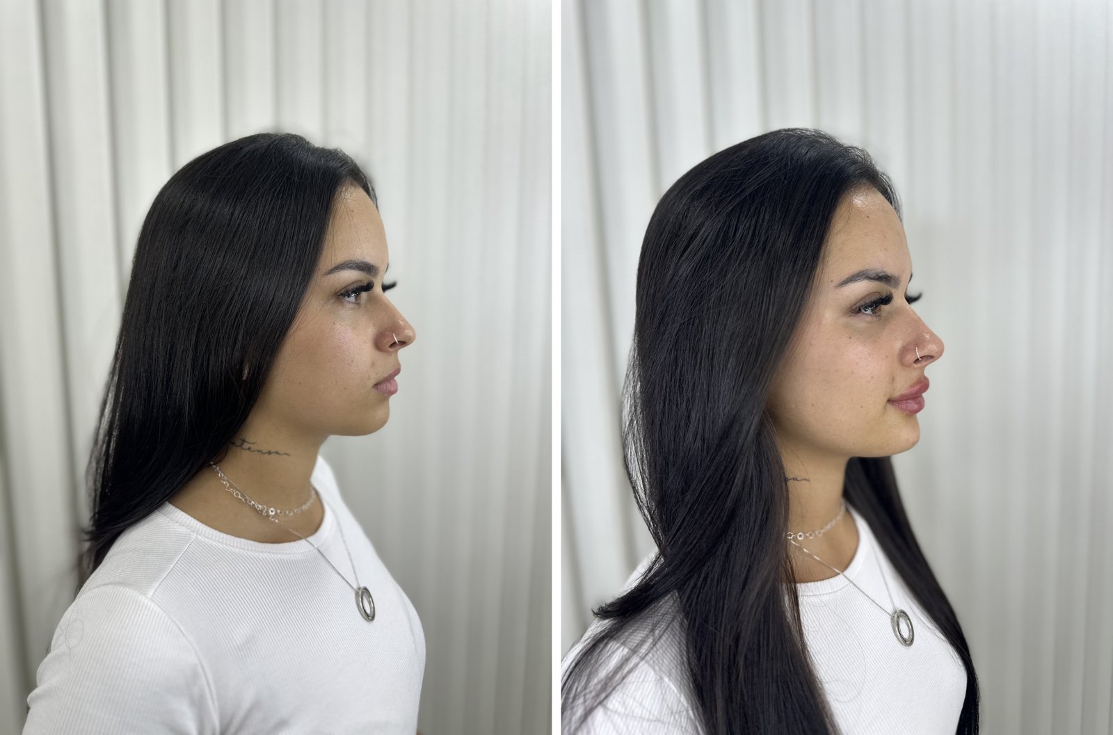 Antes e depois — caso 3