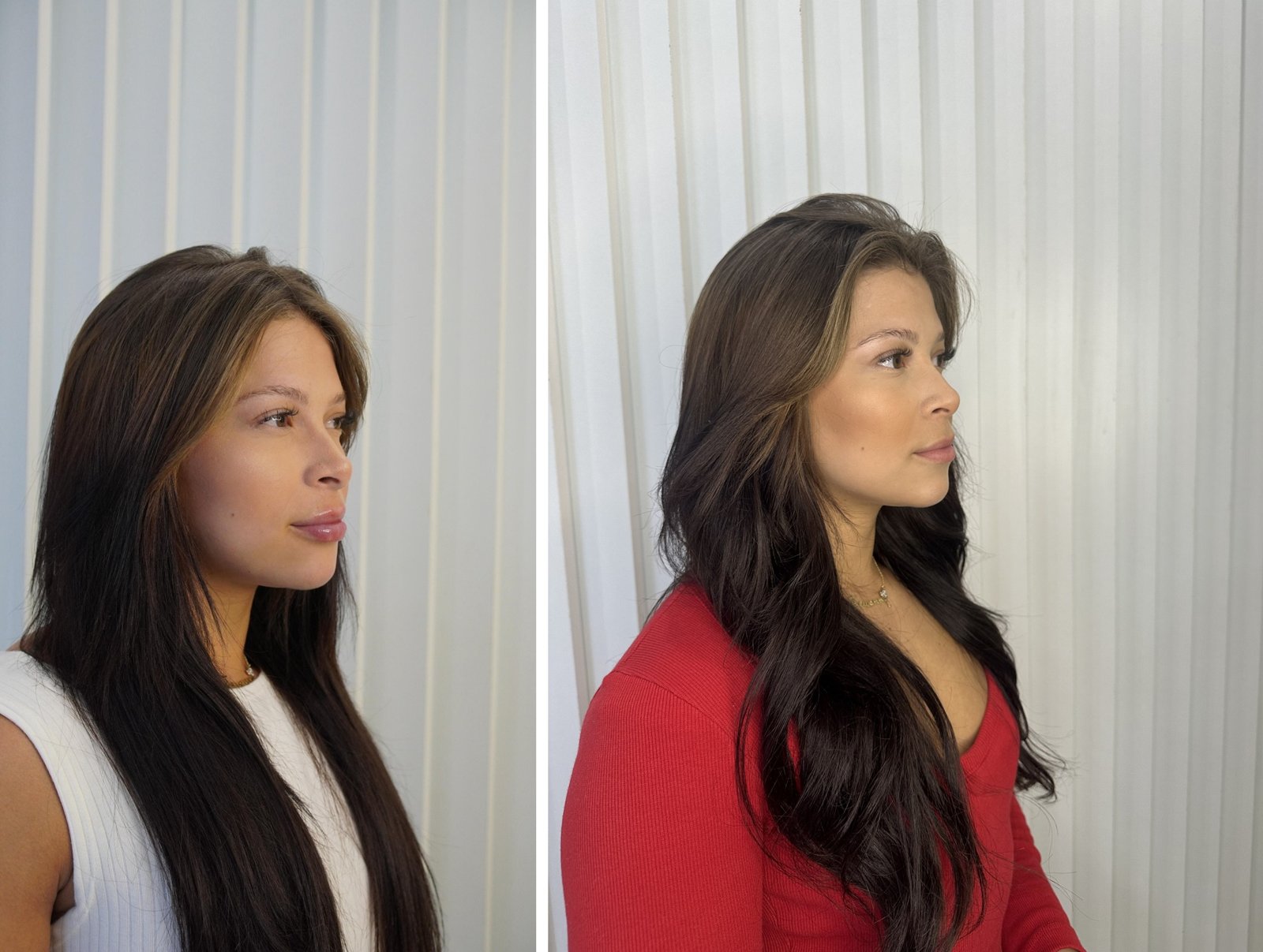 Antes e depois — caso 4